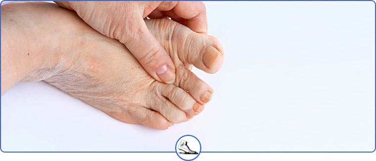 Foot Arthritis Specialists Near Me in Walnut Creek CA and Brentwood CA