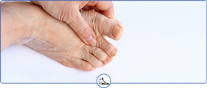 Foot Arthritis Specialists Near Me in Walnut Creek CA and Brentwood CA