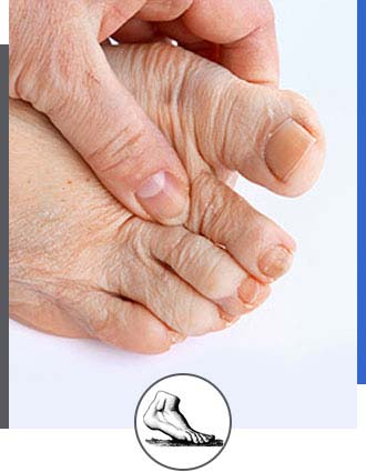 Foot Arthritis Specialist Near Me in Walnut Creek CA - Bay Area Foot and Ankle
