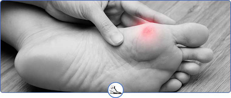 Calluses Specialist  Foot Callus Removal in Clifton and Wayne, NJ