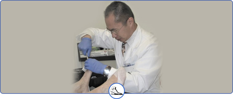 Ingrown Toenail Treatment Near Me in Walnut Creek CA and Brentwood CA