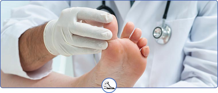 Toenail and Foot Fungus Specialist Near Me in Walnut Creek CA and Brentwood CA