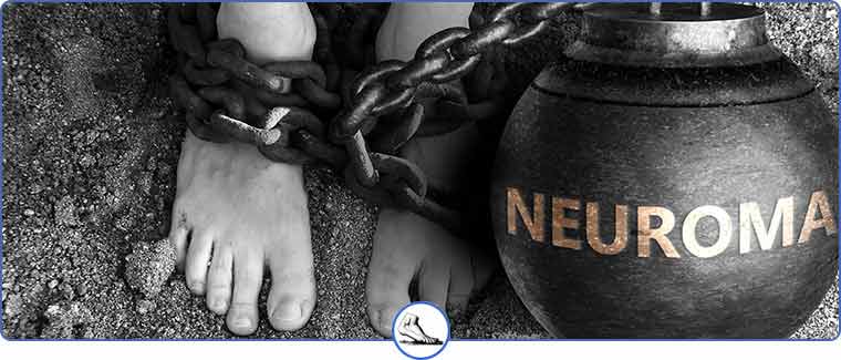 Neuroma Treatment Specialist Near Me in Walnut Creek CA and Brentwood CA Neuroma Treatment Specialist Near Me in Walnut Creek CA and Brentwood CA