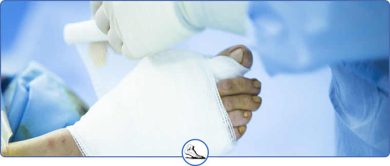 Foot and Ankle Surgery Near Me in Walnut Creek CA and Brentwood CA Foot and Ankle Surgery Near Me in Walnut Creek CA and Brentwood CA