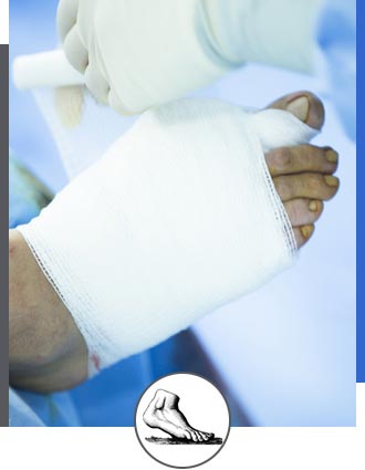 Foot and Ankle Surgery Near Me in Walnut Creek CA - Bay Area Foot and Ankle