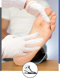 Warts Treatment Near Me in Walnut Creek CA - Bay Area Foot and Ankle