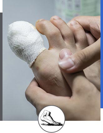 Foot and Toe Fractures Specialist Near Me in Walnut Creek and Brentwood CA