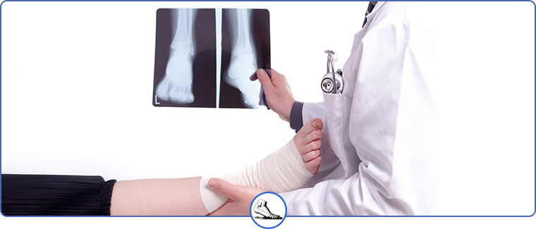 Foot X-Rays Services Near Me in Walnut Creek, CA and Brentwood, CA