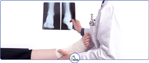 Foot X-Rays Services Near Me in Walnut Creek, CA and Brentwood, CA