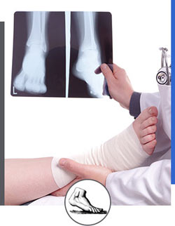 X-Rays Services Near Me in Walnut Creek CA - Bay Area Foot and Ankle