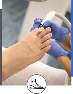 Traditional Podiatry Care Near Me in Walnut Creek CA and Brentwood CA