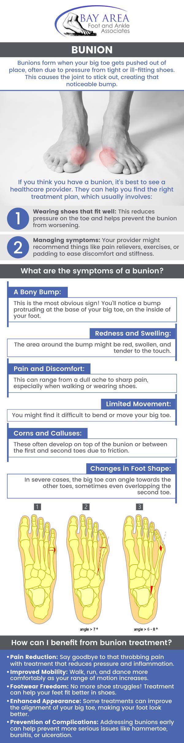 Bunion is a deformity that develops when the bone or tissue around the big toe joint shifts out of place, causing the toe to lean toward the other toes. This condition can result in pain, swelling, and redness around the joint, making it challenging to wear certain shoes or walk comfortably. If you're dealing with bunion pain or discomfort, come to Bay Area Foot and Ankle, where Dr. John W. Scivally, DPM, and Dr. Robin K. Lie, DPM offer Bunion treatment to help you get back to your regular activities. For more information, contact us or schedule an appointment online. We are conveniently located at 2400 Balfour Rd STE 230, Brentwood, CA 9451.