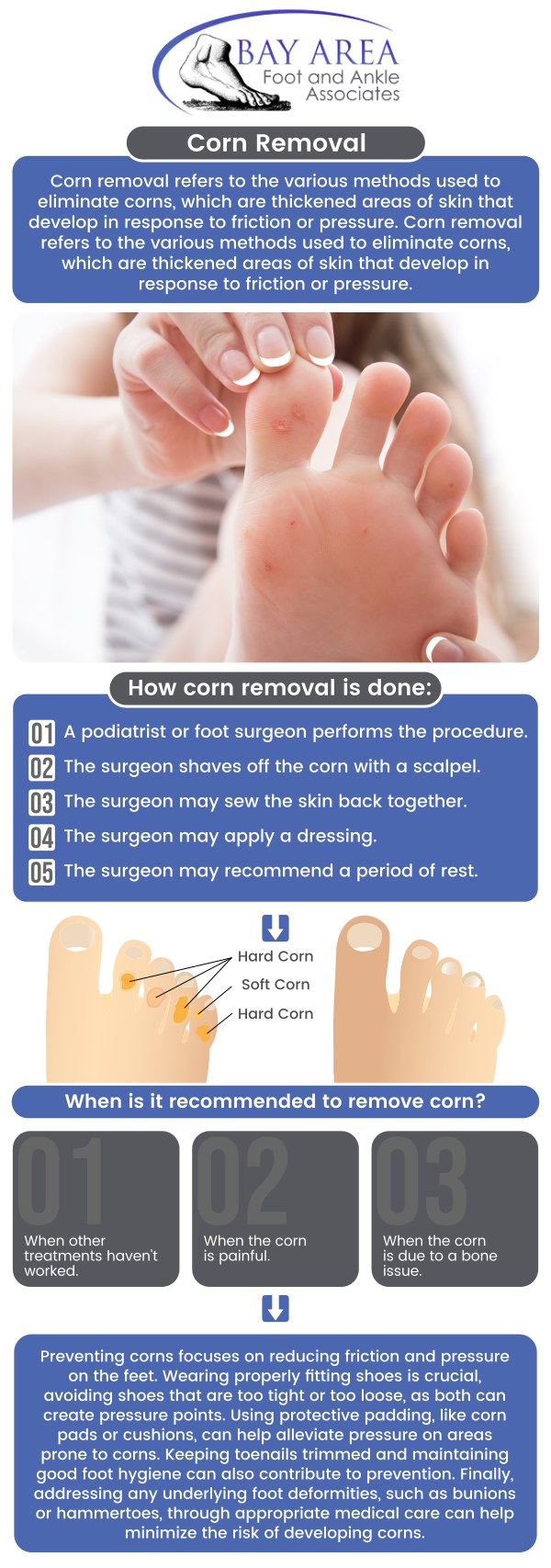 Corn removal might be required if it leads to pain or suffering, disrupts everyday activities, or becomes infected. Dr. John W. Scivally, DPM, and Robin K. Lie, DPM at Bay Area Foot and Ankle Associates offer innovative, non-invasive corn removal procedures. Visit us today to relieve corn pain, suffering, and embarrassment! For more information, contact us or schedule an appointment online. We have convenient locations to serve you in Walnut Creek, CA, and Brentwood, CA.