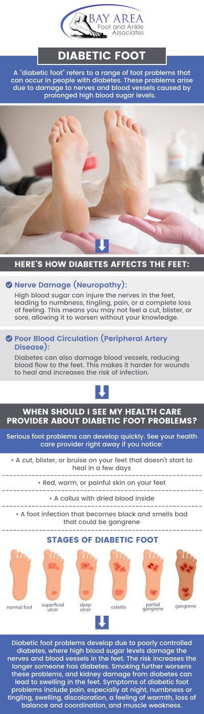 Diabetic foot encompasses various foot issues caused by diabetes, such as nerve damage and poor circulation. These conditions heighten the risk of infections and ulcers, as reduced sensation can lead to unnoticed injuries. Managing diabetic foot involves regular foot exams, proper hygiene, and prompt treatment to prevent complications. Our healthcare providers can advise on footwear, wound care, and blood sugar management to mitigate risks. Contact us today for more information or schedule an appointment online. We have convenient locations to serve you in Walnut Creek CA, and Brentwood CA. Diabetic foot encompasses various foot issues caused by diabetes, such as nerve damage and poor circulation. These conditions heighten the risk of infections and ulcers, as reduced sensation can lead to unnoticed injuries. Managing diabetic foot involves regular foot exams, proper hygiene, and prompt treatment to prevent complications. Our healthcare providers can advise on footwear, wound care, and blood sugar management to mitigate risks. Contact us today for more information or schedule an appointment online. We have convenient locations to serve you in Walnut Creek CA, and Brentwood CA.