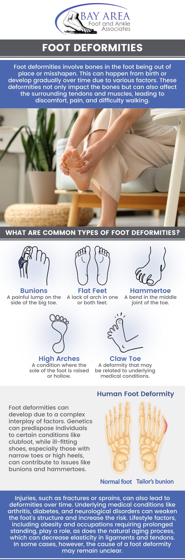 Foot Deformities can affect the way our foot functions. Foot deformities are structural issues that can change the shape and function of the feet. Common types include bunions, hammertoes, flat feet, and high arches, often caused by genetics, poor footwear, or arthritis. These conditions can result in pain, difficulty walking, and a higher risk of injury. Consulting a podiatrist is important for proper diagnosis and treatment to manage symptoms and avoid complications. For more information, contact us or book an appointment online. We have convenient locations to serve you in Walnut Creek, CA and Brentwood, CA. Foot Deformities can affect the way our foot functions. Foot deformities are structural issues that can change the shape and function of the feet. Common types include bunions, hammertoes, flat feet, and high arches, often caused by genetics, poor footwear, or arthritis. These conditions can result in pain, difficulty walking, and a higher risk of injury. Consulting a podiatrist is important for proper diagnosis and treatment to manage symptoms and avoid complications. For more information, contact us or book an appointment online. We have convenient locations to serve you in Walnut Creek, CA and Brentwood, CA.