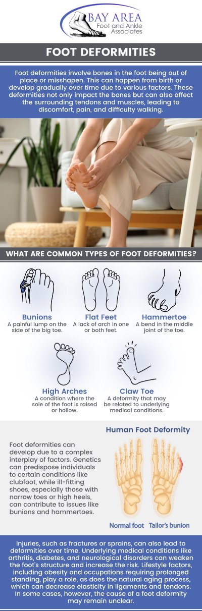 Foot Deformities can affect the way our foot functions. Foot deformities are structural issues that can change the shape and function of the feet. Common types include bunions, hammertoes, flat feet, and high arches, often caused by genetics, poor footwear, or arthritis. These conditions can result in pain, difficulty walking, and a higher risk of injury. Consulting a podiatrist is important for proper diagnosis and treatment to manage symptoms and avoid complications. For more information, contact us or book an appointment online. We have convenient locations to serve you in Walnut Creek, CA and Brentwood, CA. Foot Deformities can affect the way our foot functions. Foot deformities are structural issues that can change the shape and function of the feet. Common types include bunions, hammertoes, flat feet, and high arches, often caused by genetics, poor footwear, or arthritis. These conditions can result in pain, difficulty walking, and a higher risk of injury. Consulting a podiatrist is important for proper diagnosis and treatment to manage symptoms and avoid complications. For more information, contact us or book an appointment online. We have convenient locations to serve you in Walnut Creek, CA and Brentwood, CA.