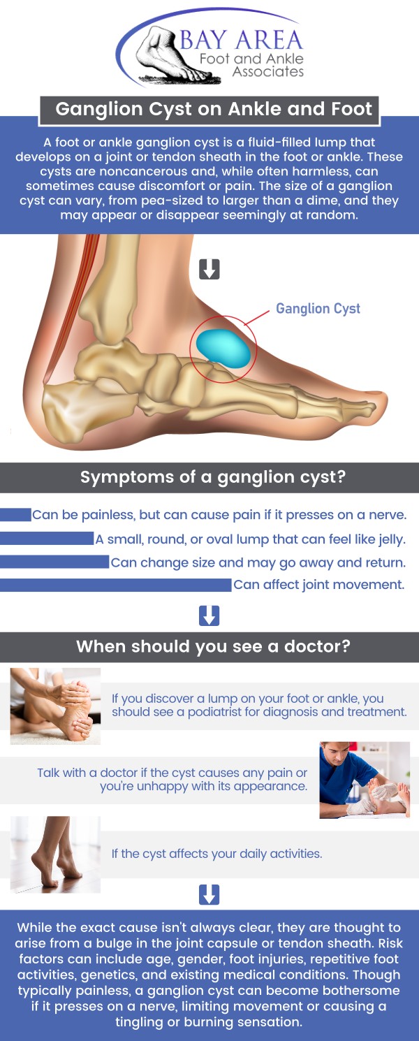 Ganglion cyst is a noncancerous lump that commonly forms along the tendons or joints of the feet. Filled with jelly-like fluid, these cysts can vary in size and may develop due to tissue bulging around a joint or tendon, often following irritation or injury. While some ganglion cysts go away on their own, others may need to be removed, especially if they are causing pain or hindering movement. Visit Dr. John W. Scivally, DPM, and Robin K. Lie, DPM at Bay Area Foot and Ankle Associates. Contact us for more information or schedule an appointment online. We have convenient locations in Walnut Creek, CA, and Brentwood, CA. Ganglion cyst is a noncancerous lump that commonly forms along the tendons or joints of the feet. Filled with jelly-like fluid, these cysts can vary in size and may develop due to tissue bulging around a joint or tendon, often following irritation or injury. While some ganglion cysts go away on their own, others may need to be removed, especially if they are causing pain or hindering movement. Visit Dr. John W. Scivally, DPM, and Robin K. Lie, DPM at Bay Area Foot and Ankle Associates. Contact us for more information or schedule an appointment online. We have convenient locations in Walnut Creek, CA, and Brentwood, CA.