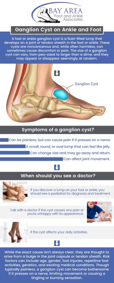 Ganglion cyst is a noncancerous lump that commonly forms along the tendons or joints of the feet. Filled with jelly-like fluid, these cysts can vary in size and may develop due to tissue bulging around a joint or tendon, often following irritation or injury. While some ganglion cysts go away on their own, others may need to be removed, especially if they are causing pain or hindering movement. Visit Dr. John W. Scivally, DPM, and Robin K. Lie, DPM at Bay Area Foot and Ankle Associates. Contact us for more information or schedule an appointment online. We have convenient locations in Walnut Creek, CA, and Brentwood, CA. Ganglion cyst is a noncancerous lump that commonly forms along the tendons or joints of the feet. Filled with jelly-like fluid, these cysts can vary in size and may develop due to tissue bulging around a joint or tendon, often following irritation or injury. While some ganglion cysts go away on their own, others may need to be removed, especially if they are causing pain or hindering movement. Visit Dr. John W. Scivally, DPM, and Robin K. Lie, DPM at Bay Area Foot and Ankle Associates. Contact us for more information or schedule an appointment online. We have convenient locations in Walnut Creek, CA, and Brentwood, CA.