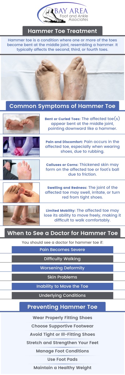 Hammertoe is a deformity that causes your toe to bend or curl downward instead of pointing forward. This can affect any toe on your foot, but it most often affects the second or third toe. If you are suffering from an uncomfortable hammertoe, it's time to see Dr. John W. Scivally, DPM, and Dr. Robin K. Lie, DPM, and correct it before it progresses any further. Hammertoe treatment is available at Bay Area Foot and Ankle Associates. For more information, contact us or schedule an appointment online. We have convenient locations to serve you in Walnut Creek, and Brentwood, CA.