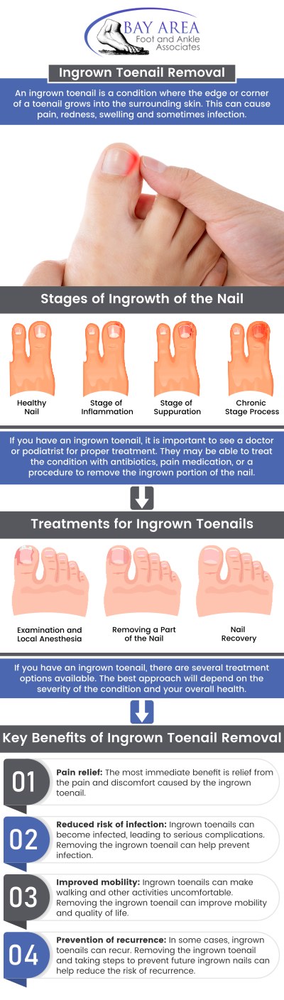Ingrown toenail treatment focuses on alleviating the discomfort produced by a toenail's edge growing into the surrounding skin, causing swelling, redness, and the possibility of infection. To properly manage and avoid ingrown toenails, it is imperative to wear appropriate footwear, take good care of your nails, and seek treatment as soon as possible. Visit Dr. John W. Scivally, DPM, and Dr. Robin K. Lie, DPM, at Bay Area Foot and Ankle to get relief from your pain and discomfort today. For more information, contact us or schedule an appointment online! We have convenient locations to serve you in Walnut Creek and Brentwood, CA.