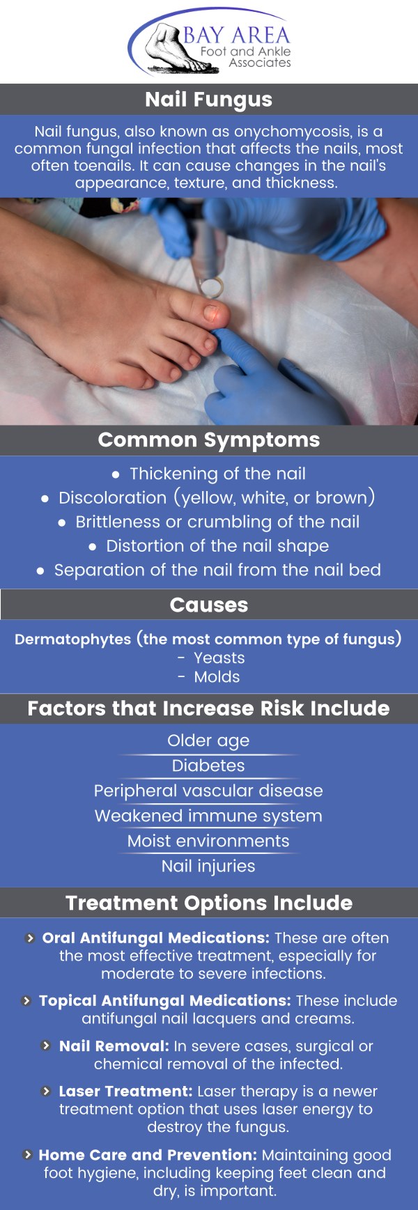 Toenail fungus, or onychomycosis, occurs when fungi infect the toenail, leading to discoloration, thickening, and brittleness. It typically starts as a white or yellow spot at the tip and can cause pain and difficulty walking if it spreads. Poor foot hygiene, tight shoes, and damp environments can increase the risk. If you notice symptoms, it's important to seek medical advice for diagnosis and treatment. Visit Bay Area Foot and Ankle Associates, Dr. John W. Scivally, DPM, and Dr. Robin K. Lie, DPM can assess and treat your concerns. For more information, contact us or schedule an appointment online. We have convenient locations to serve you in Walnut Creek CA, and Brentwood CA.