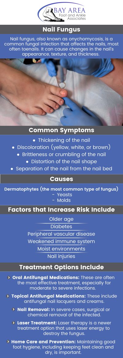 Toenail fungus, or onychomycosis, occurs when fungi infect the toenail, leading to discoloration, thickening, and brittleness. It typically starts as a white or yellow spot at the tip and can cause pain and difficulty walking if it spreads. Poor foot hygiene, tight shoes, and damp environments can increase the risk. If you notice symptoms, it's important to seek medical advice for diagnosis and treatment. Visit Bay Area Foot and Ankle Associates, Dr. John W. Scivally, DPM, and Dr. Robin K. Lie, DPM can assess and treat your concerns. For more information, contact us or schedule an appointment online. We have convenient locations to serve you in Walnut Creek CA, and Brentwood CA.