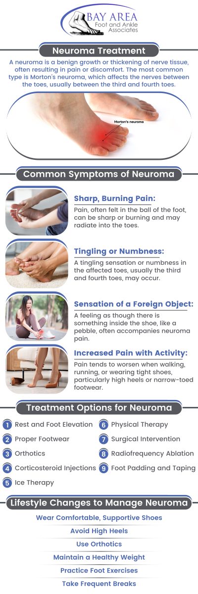 A neuroma is a benign growth of nerve tissue that often forms between the toes, commonly referred to as Morton's neuroma. This condition typically occurs between the third and fourth toes and can lead to symptoms such as sharp, burning pain, numbness, or the sensation of a lump in the foot. If you are experiencing these symptoms, consult Dr. John W. Scivally, DPM, and Dr. Robin K. Lie, DPM for an accurate diagnosis and effective treatment options. For more information, contact us or schedule an appointment online. We have convenient locations to serve you in Walnut Creek CA, and Brentwood CA.